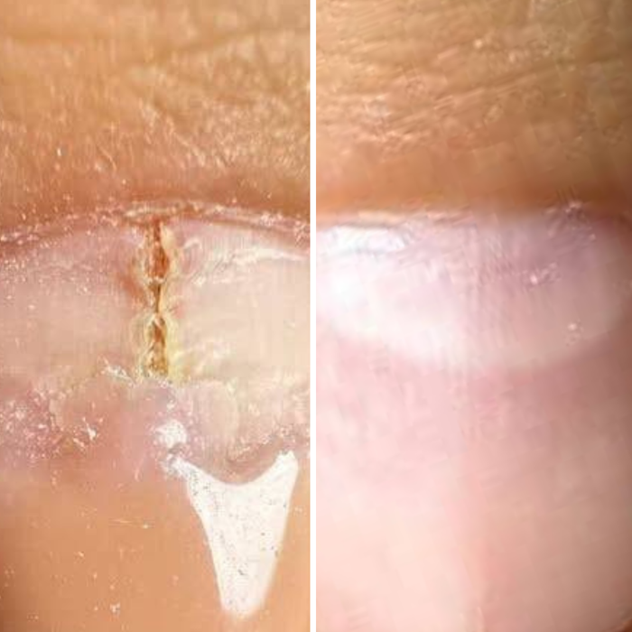 Resultum Onistopix Oil, 8-15 ml