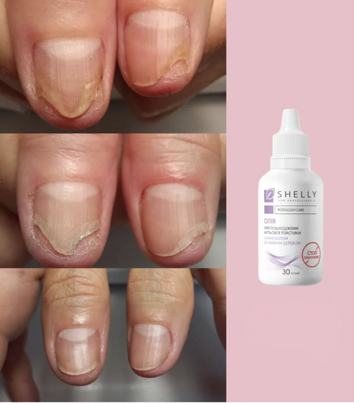 Shelly Revitalizing oil for weakened nails with farnesol and tea tree, 30 ml - Ivaka Store