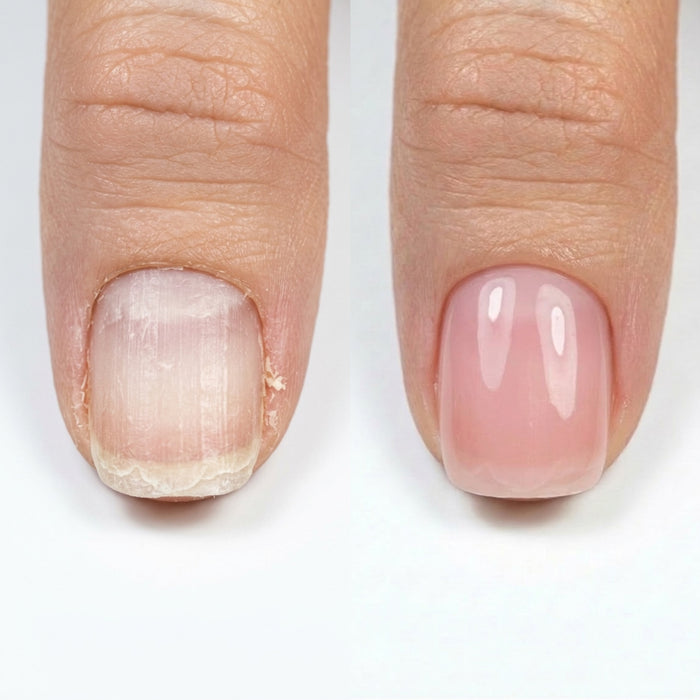 Resultum Nail Polish Hardener S.O.S Rosa