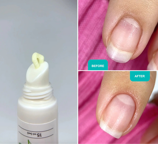 Shelly Strengthening balm for nail and cuticle with bisabolol and eucalyptus, 15 ml - Ivaka Store