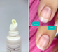 Shelly Strengthening balm for nail and cuticle with bisabolol and eucalyptus, 15 ml - Ivaka Store