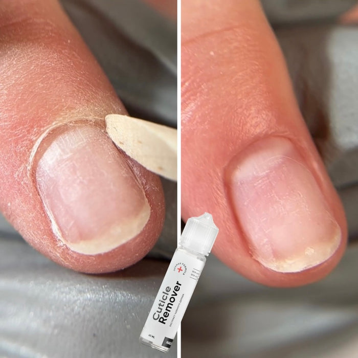 NAILSOFTHEDAY Cuticle Remover – Regenerierender Nagelhautentferner für Maniküre und Pediküre, Urea 10%, 60 ml