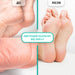 Shelly Keratolytisches Gel zur Entfernung von Hühneraugen und Hornhaut „Soft Blade“, 200 ml - Ivaka Store