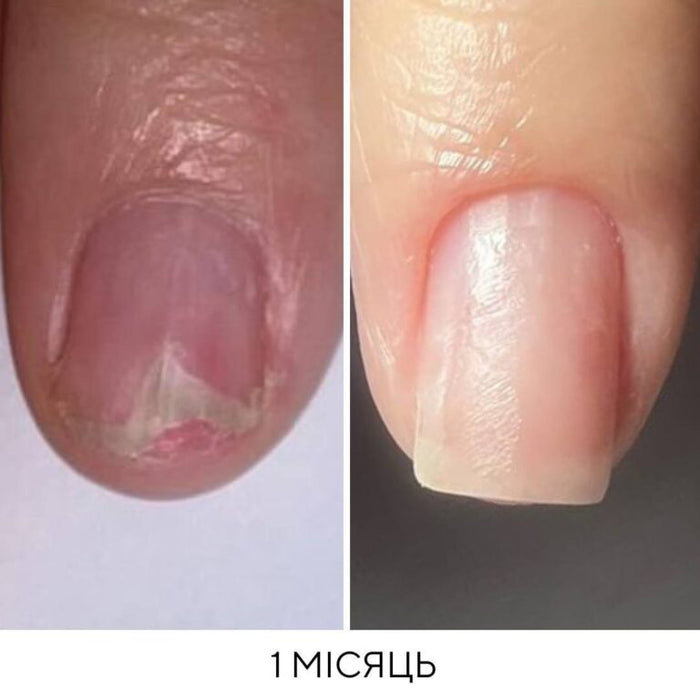 NAILSOFTHEDAY Onistop, ONYCHOLYSE Molecular Oil, 15 m