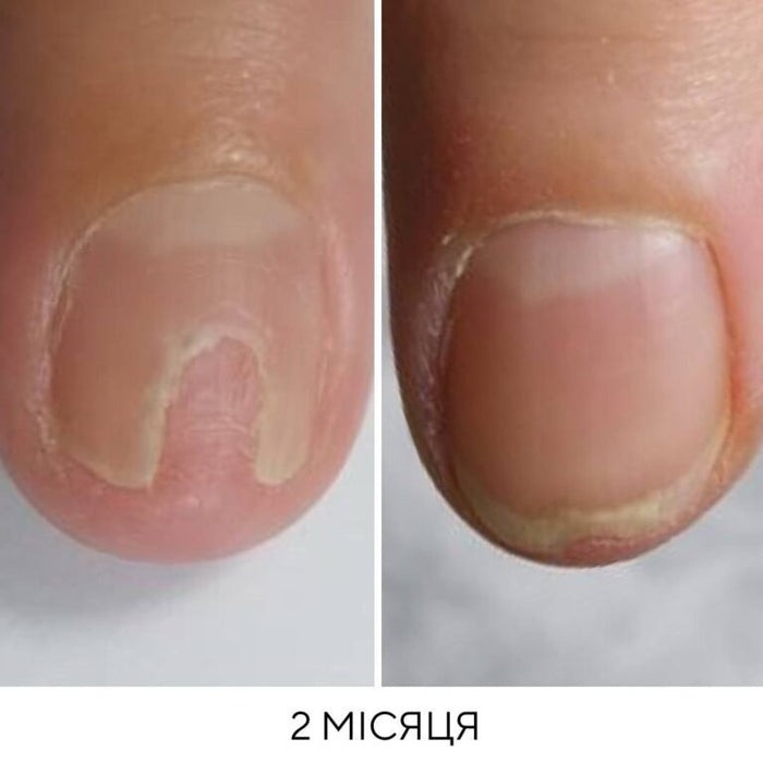 NAILSOFTHEDAY Onistop, ONYCHOLYSE Molecular Oil, 8 m