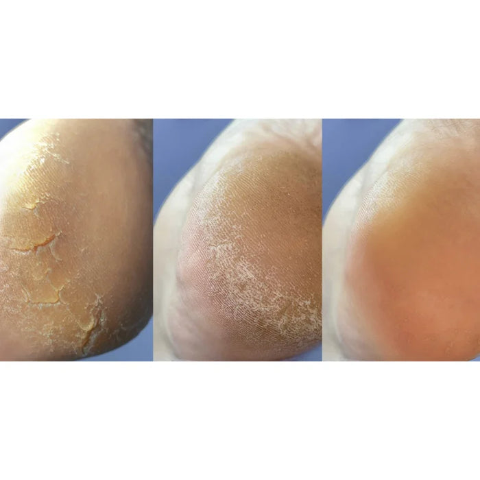 NAILSOFTHEDAY Podology+ Creme gegen Risse für Füße und Hände, 30 ml - Ivaka Store